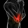 Elbow Arthritis & Stiffness