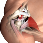 Subacromial Impingement